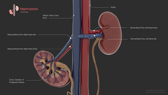 ISCHEMIA Non Medical.png