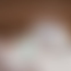 Así de angustiante es vivir con lipedema en Chile: sin cobertura y confundida con obesidad