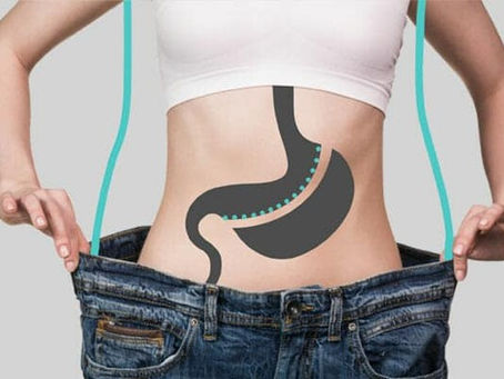 CONSEJOS PARA EL ÉXITO EN LA PÉRDIDA DE PESO A LARGO PLAZO TRAS LA CIRUGÍA BARIÁTRICA