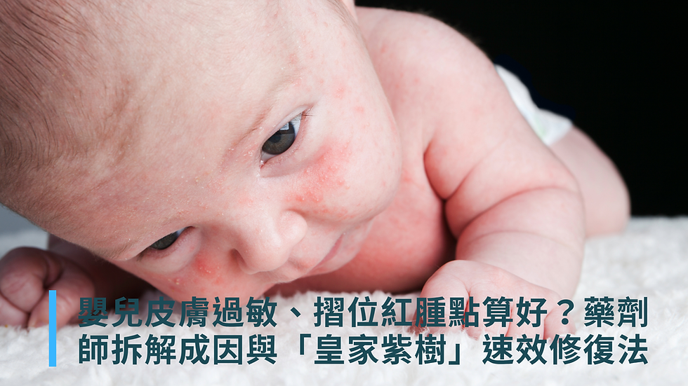 嬰兒皮膚過敏、摺位紅腫點算好?藥劑師拆解成因與「皇家紫樹」速效修復法