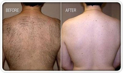 skin hair laser Hospitals in kumbakonam-Napolean Hospital