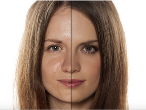 difference between oily and matte looking face