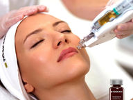 Mesotherapie - der Schlüssel zu strahlend schöner Haut