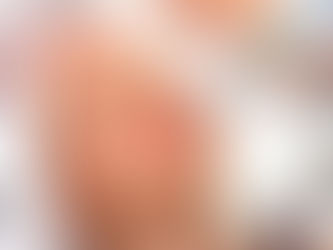 Mesotherapie - der Schlüssel zu strahlend schöner Haut