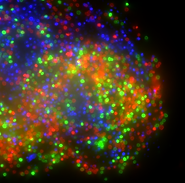 ACO_Saci_WT_aggregate_scale10um.tif