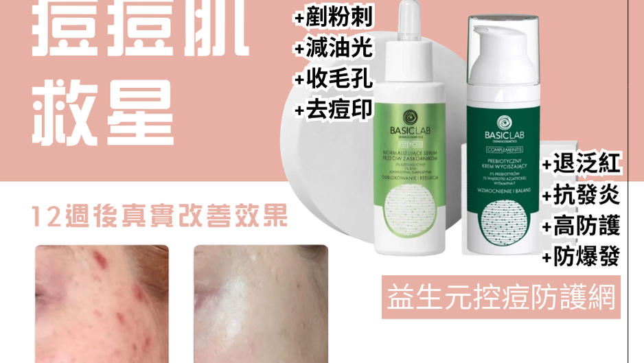 痘痘肌恩物 ✨ 告別暗瘡、痘印、粗毛孔！呢兩瓶夾埋一齊用，塊面乾淨晒！