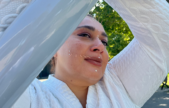 Art'cupuncture project.HEIC