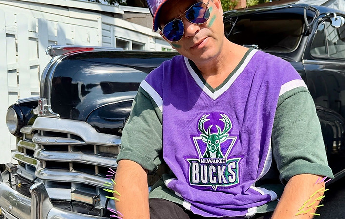 Projet art'cupuncture.JPG