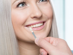 Porcelain Veneers Benefits