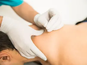 Discover WhatDry Needling Is, How It Works, and What Types of Problems It Can Treat. Learn More Here!