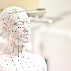 Acupuncture's Growing Role in Modern Healthcare