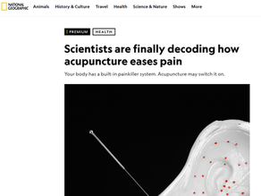 "Scientists are Finally Decoding how Acupuncture Eases Pain: