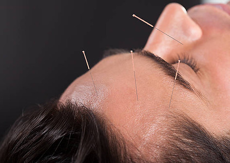 male acupunucture.jpg