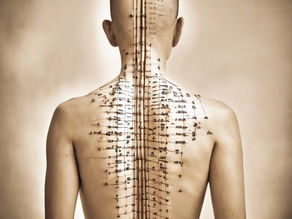Exploring the Connection Between the Parasympathetic Nervous System and Acupuncture Benefits