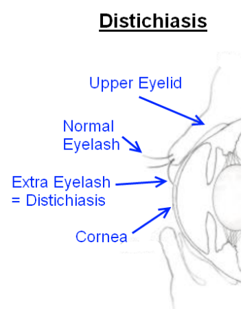 November 2017 Dachshund Eye Screening Summary