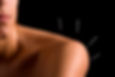 dry-needles-shoulder.jpg