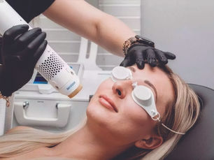 The Benefits of Laser Skin Treatments