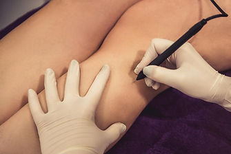 electrolysis (1).jpg