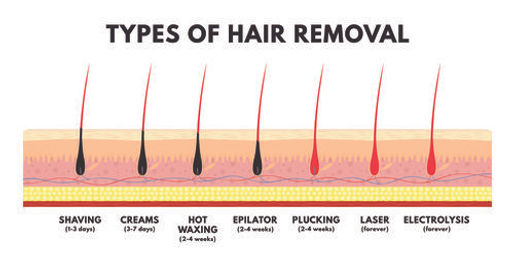 types_of_hair_removal.jpg