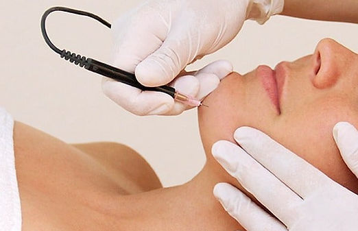Everything-you-need-to-know-about-electrolysis.jpg