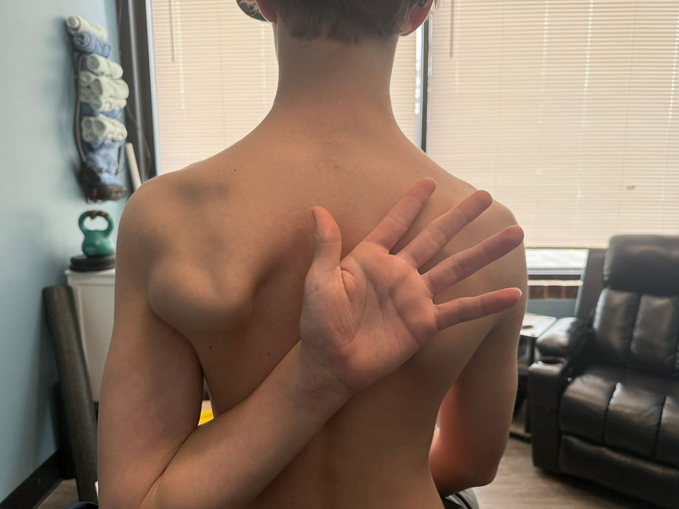 Shirtless person seen from behind in a clinic room, with a hand raised behind their back; blinds, chair, and therapy tools in background