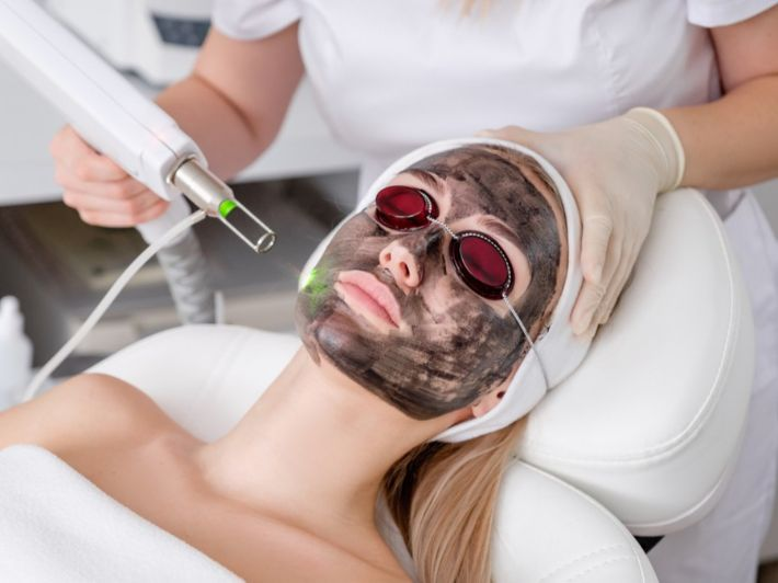 Laser Carbon Peel in Dubai
