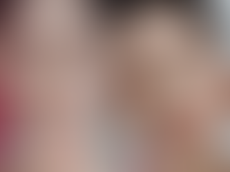 完成液態PCL膠原針的女生