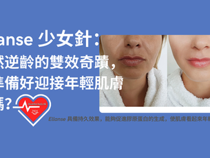 Ellanse 少女針自然逆齡的雙效奇蹟