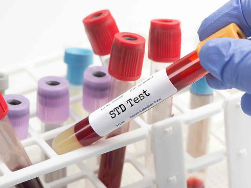 STD testing near Duluth