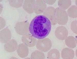 Resultado de imagem para monócito