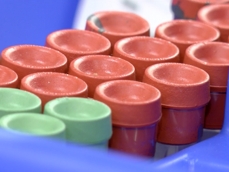 Area Number of Flu Cases on the Rise