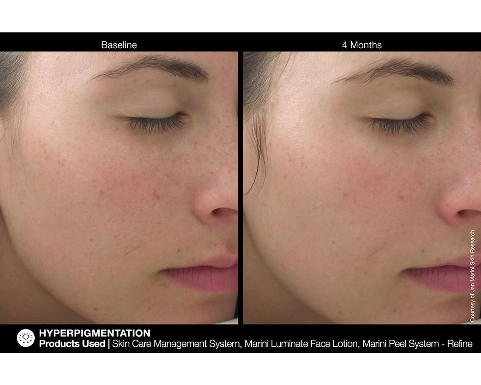 Thumbnail: Marini Luminate Face Lotion