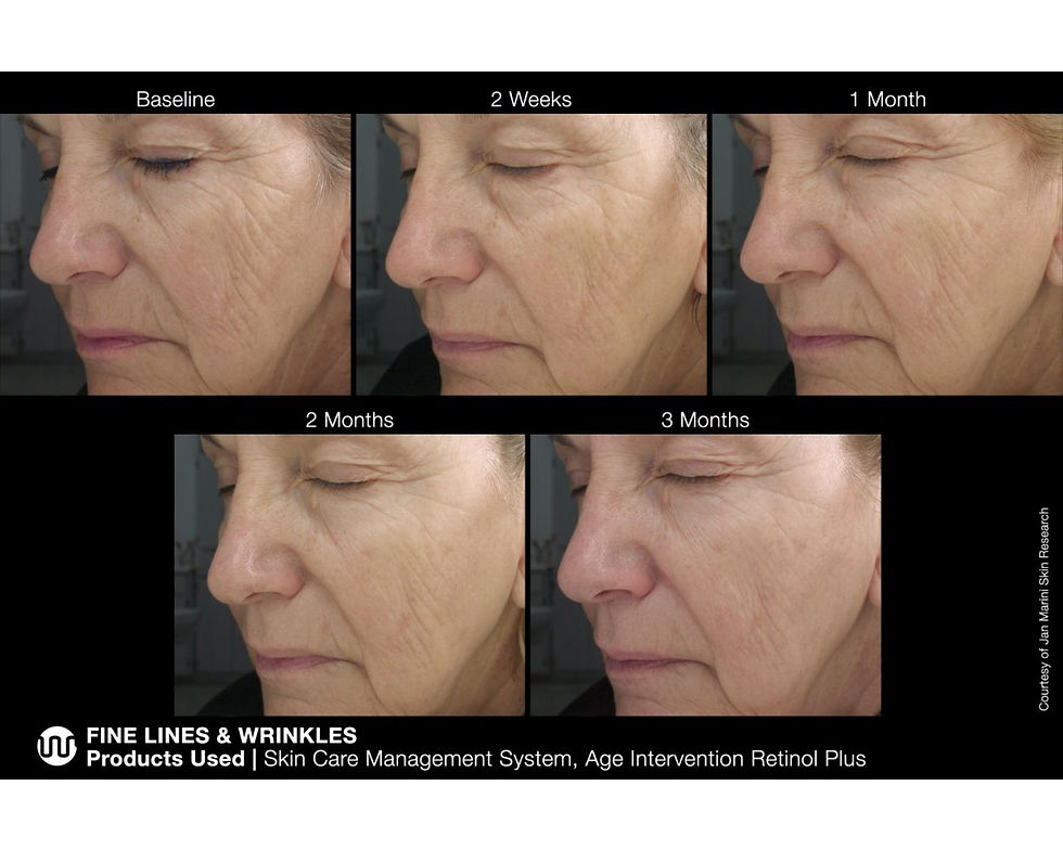 Thumbnail: Age Intervention Retinol Plus