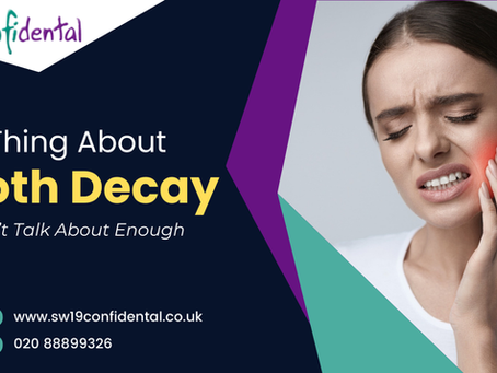 tooth decay treatment in London