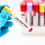 Thumbnail: Total Cholesterol (HDL, LDL, VLDL)
