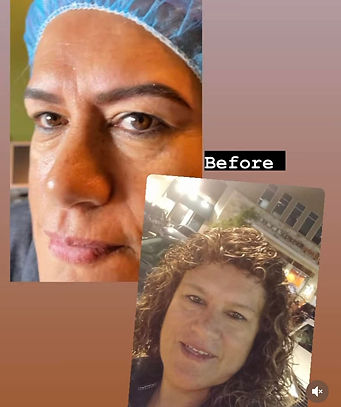 MICROPIGMENTATION.jpg