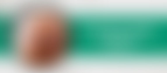 Is an FUE Hair Transplant Permanent?