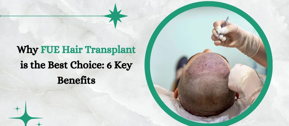 Why FUE Hair Transplant is the Best Choice: 6 Key Benefits