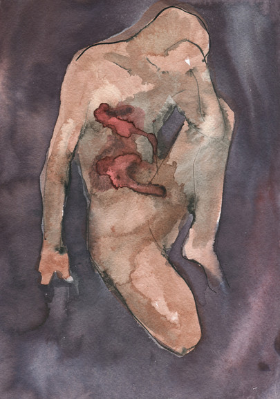 Wounded
