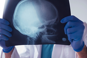 Brain Injury