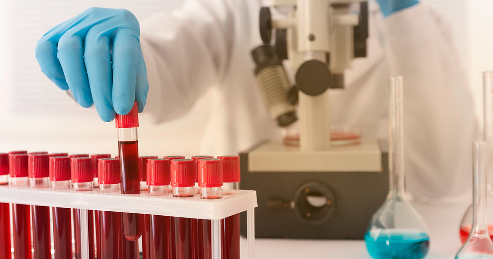 Os benefícios de se fazer um hemograma todo ano