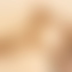 Álcool, praia e calor: veja problemas que a combinação traz para seu corpo