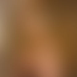 Como o cigarro prejudica a fertilidade