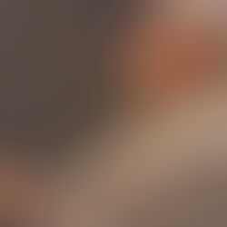 Hábitos que ajudam a reduzir o risco de demência e declínio cognitivo