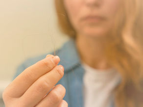 Anticoncepcional pode provocar queda de cabelo?