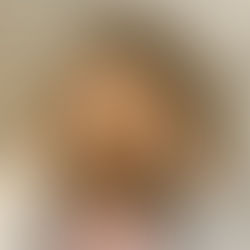 Dor de cabeça é normal?