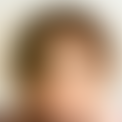 Calvície em homens e mulheres: entenda as diferenças na queda de cabelo