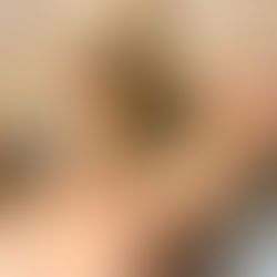 Ficar muito tempo no sol pode trazer vários problemas