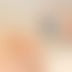 Conheça os sinais que o corpo dá quando a glicose está alta