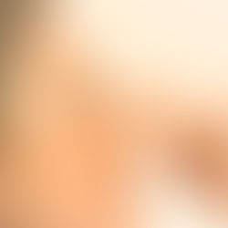 O nariz pode dizer muito sobre a sua saúde